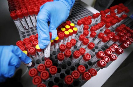 질병청 “오미크론 증상발현 후 최대 8일까지 바이러스 배출”